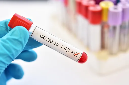 Jandaia do Sul registra 37 novos casos de Covid-19